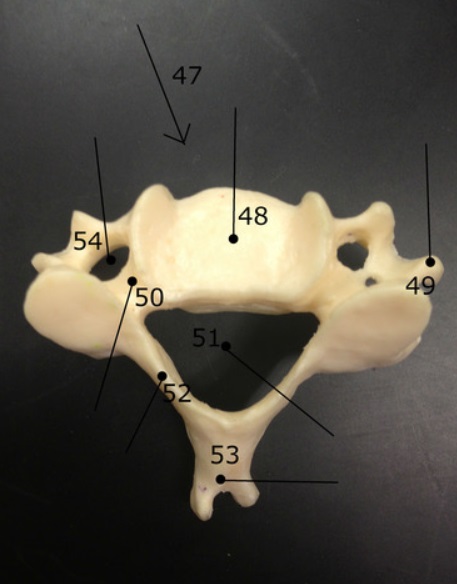 <p>what type of vertebra is this?</p>