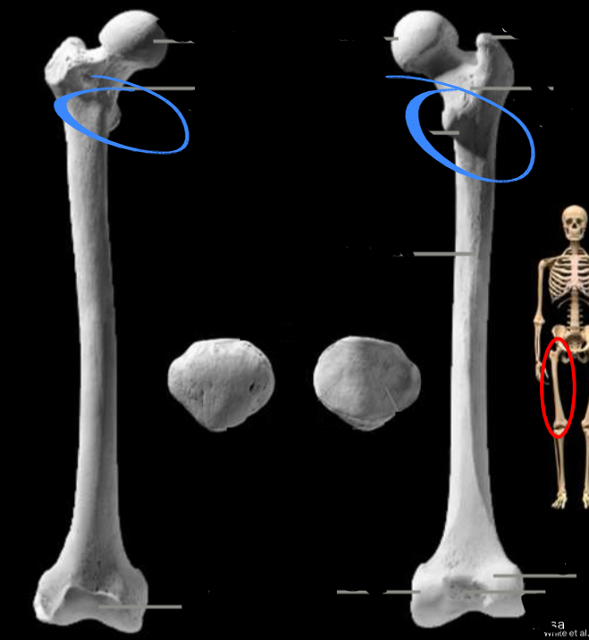 <p>Attachment for glute musculature, located on the femur</p>