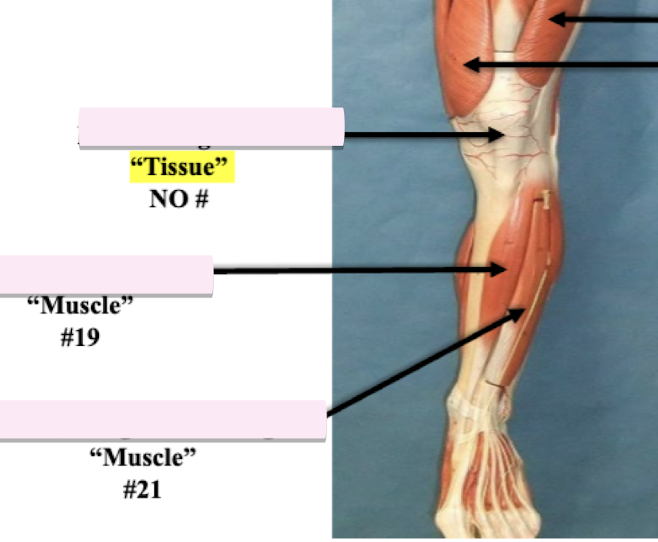 <p>Label muscle #21 </p>