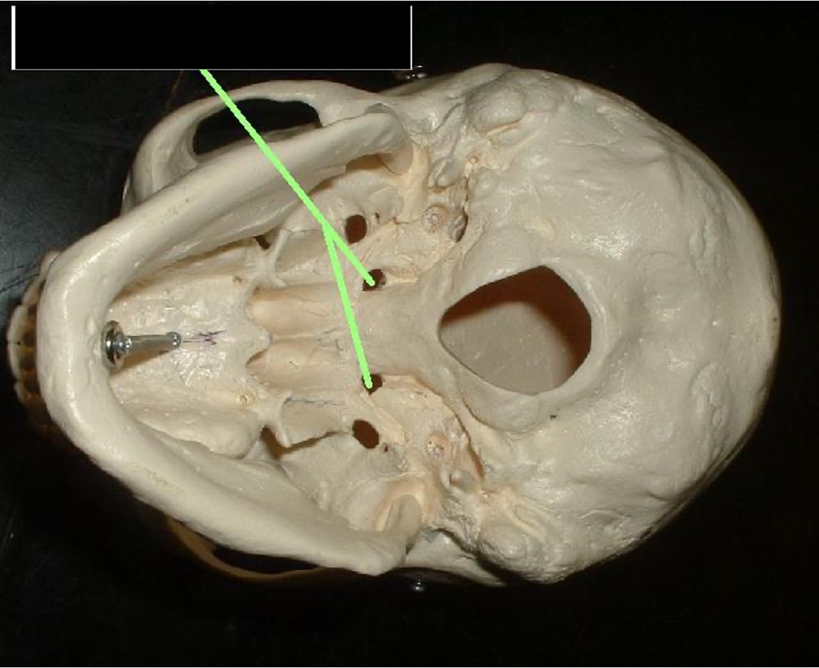 <p>two holes that are close together in front of the carotid foramen</p>