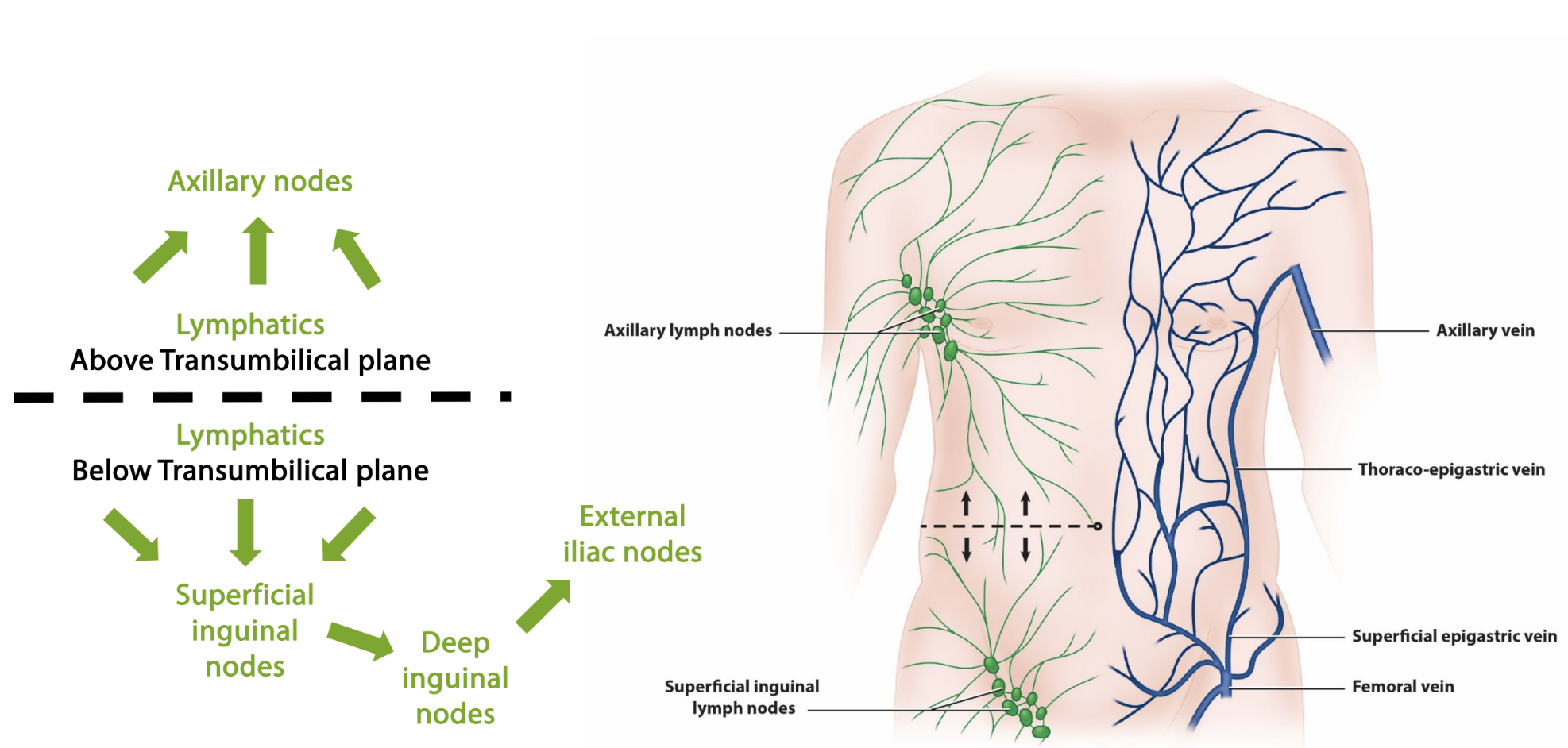 <p><strong>abdominal wall</strong></p><ul><li><p>lymphatics above transumbilical plane go to _____</p></li><li><p>lymphatics below transumbilical plane go to _____</p></li></ul><p></p>