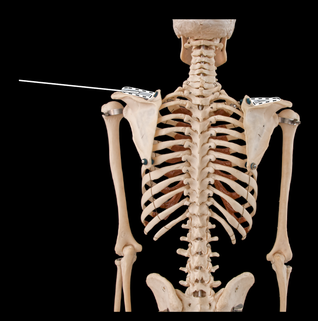 <p>Name this bone.</p><p>(Posterior view).</p>