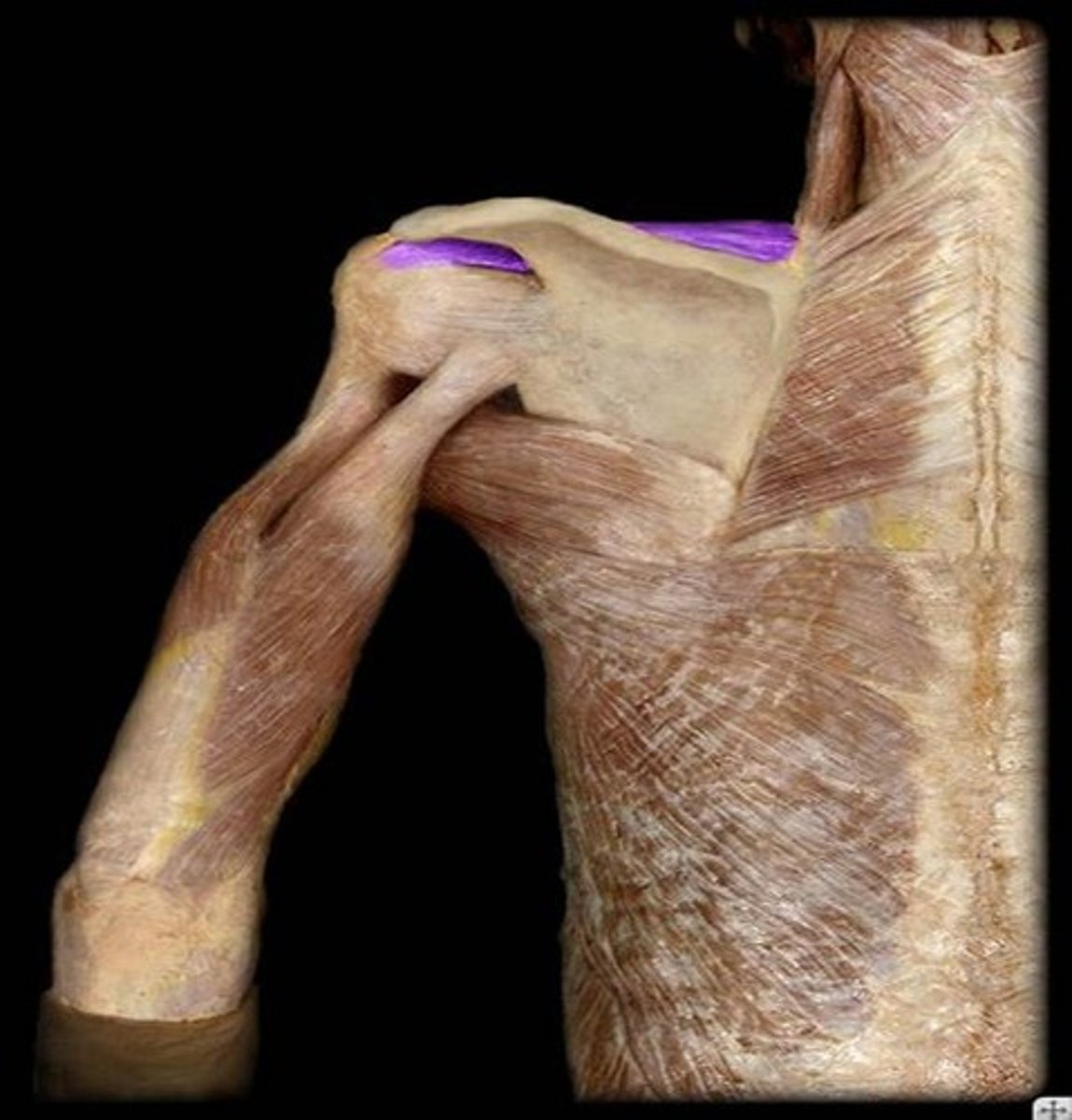 <p>What is the name of this muscle, highlighted in purple?</p>