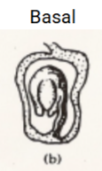 <p>Basal placentation</p>