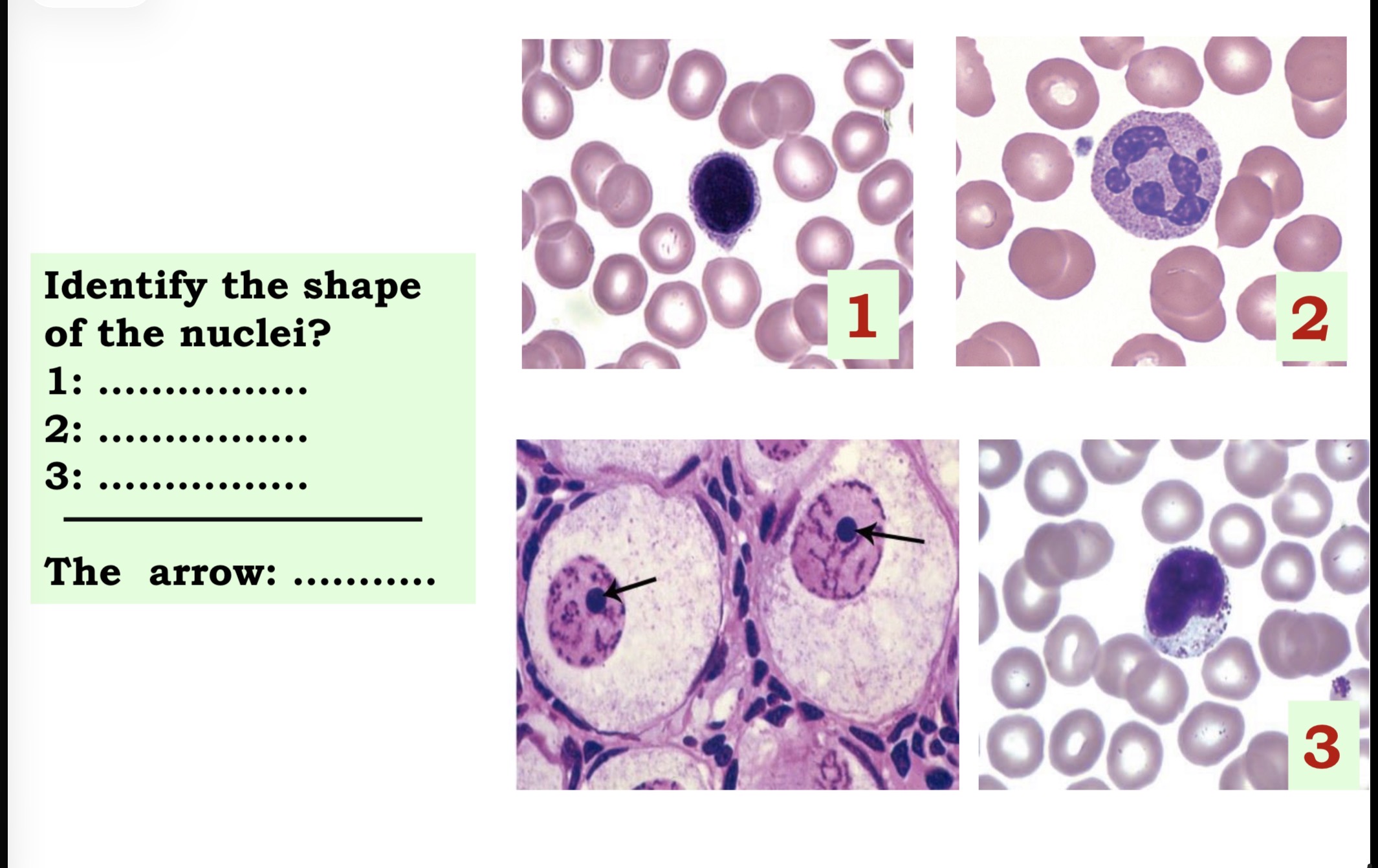 <p>Answer the questions in these following pictures </p>