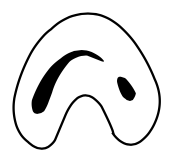 <p>should be no less than 60 degrees</p><p>the canal shape resembles a <span style="color: red;">semicolon</span> resulting from a <span style="color: red;">discontinuation of the “C” </span>outline</p>