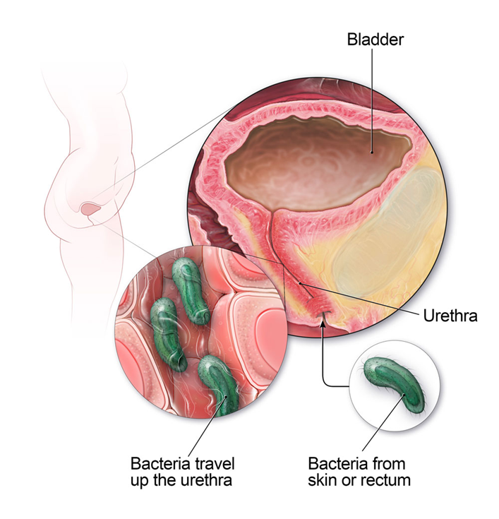 <p>UTI: Diagnostics </p>