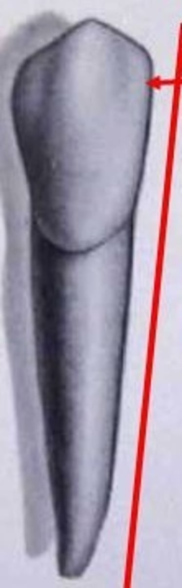 <p>True or false? A distinguishing characteristic of mandibular canines is the relatively straight line of the mesial outline, compared to the distal outline.</p>