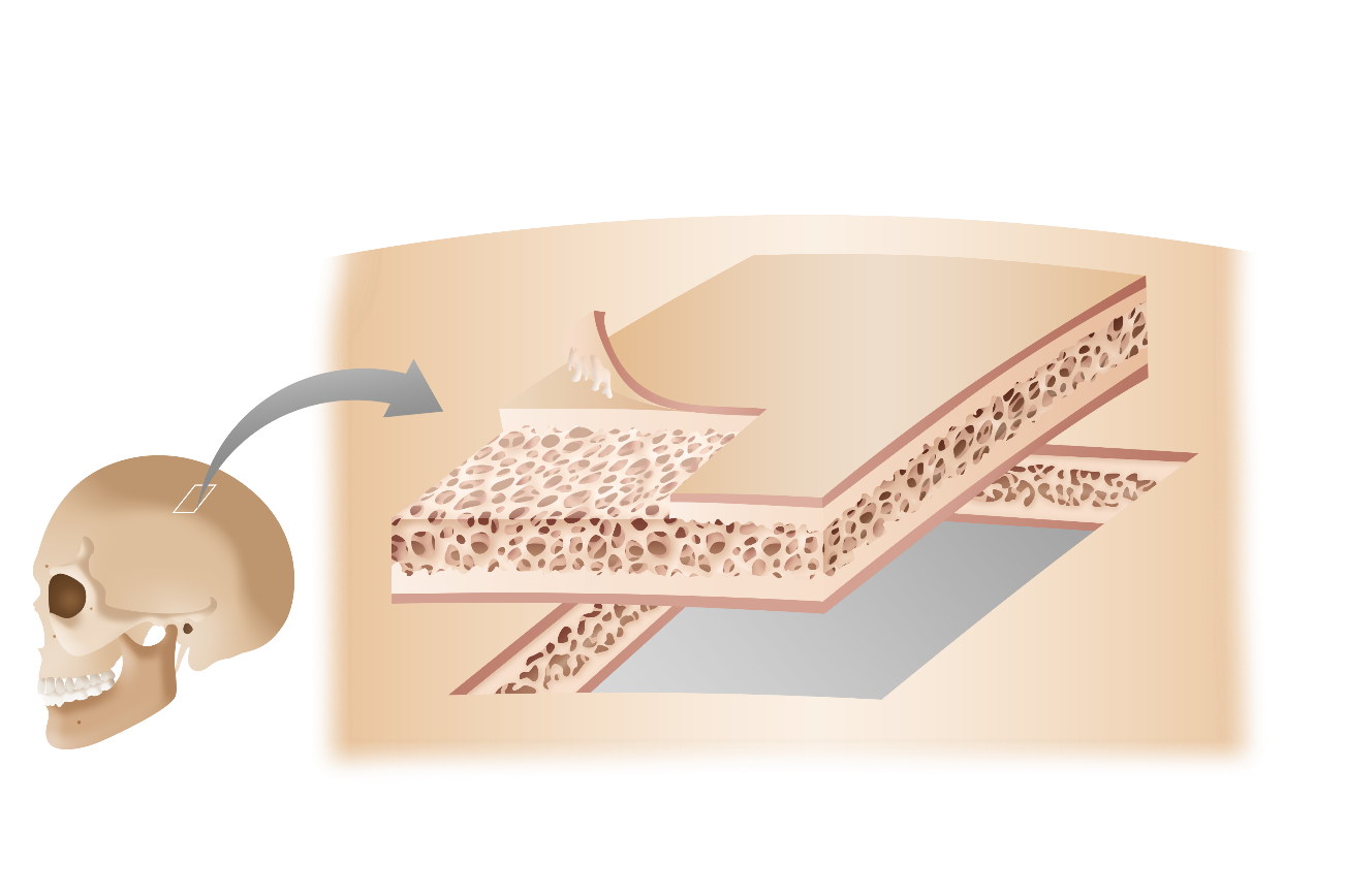 <p>Flat bones</p>