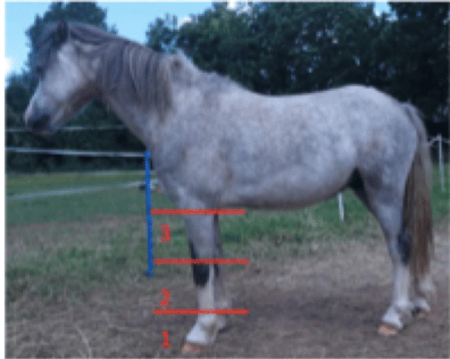 <p>Proximal and middle radius</p>