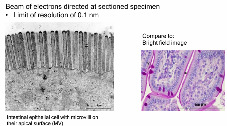 <ul><li><p>Regular Electron Microscope:</p><ul><li><p><span>λ = 0.005nm</span></p></li><li><p><span>D = 0.1nm</span></p></li></ul></li><li><p>TEM</p><ul><li><p>beam is directed through thinly slices specimen to form an image&nbsp;</p></li><li><p>Stained/dense areas appear dark </p></li><li><p>Unstained/sparse areas appear light&nbsp;</p></li></ul></li><li><p>52,000x magnification compared to brightfield image&nbsp;</p></li></ul><p></p>