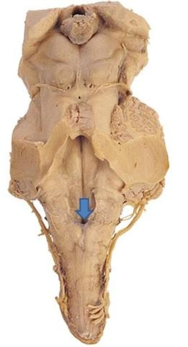 <p>obex</p>