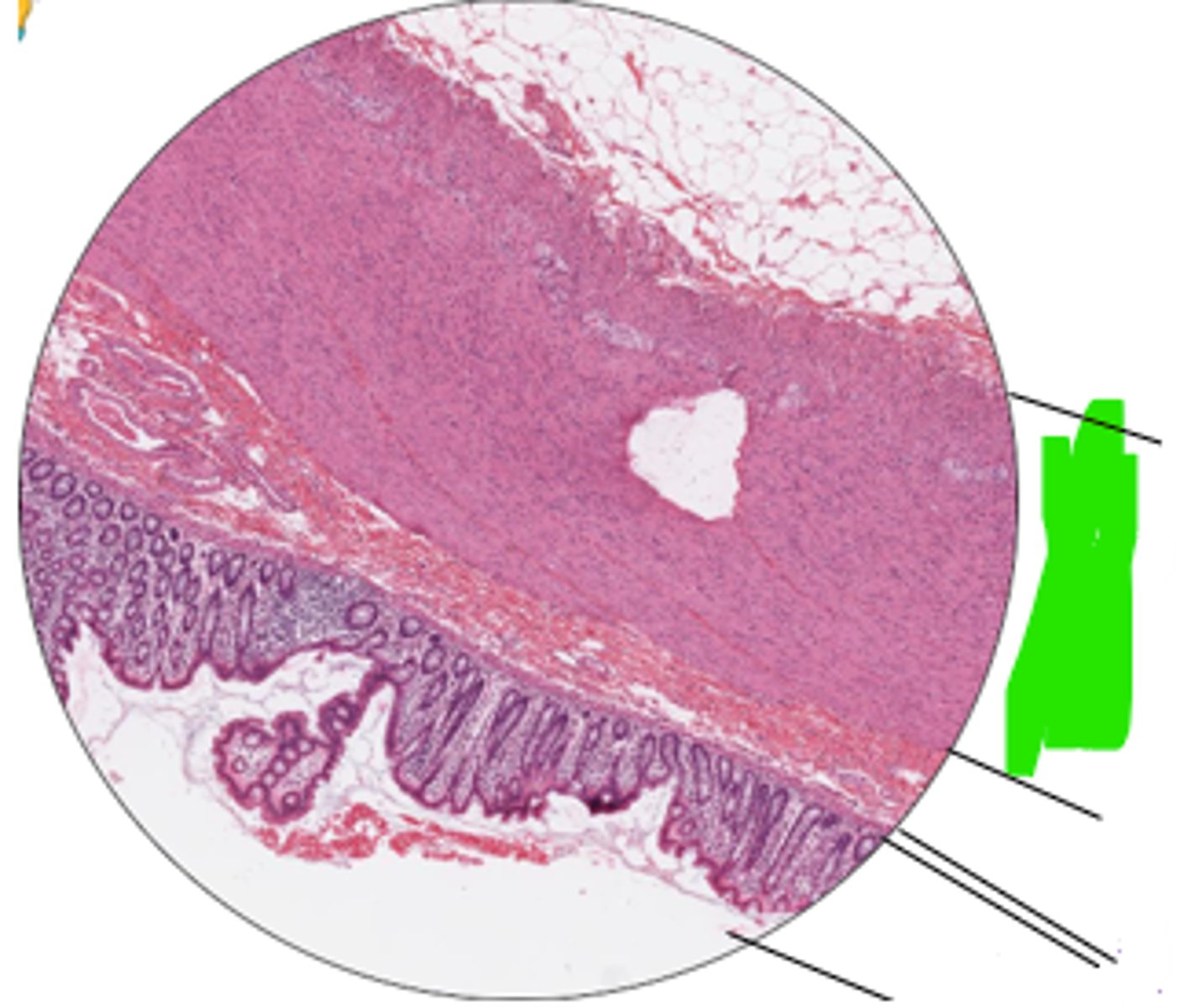 <p>region and organ?</p>