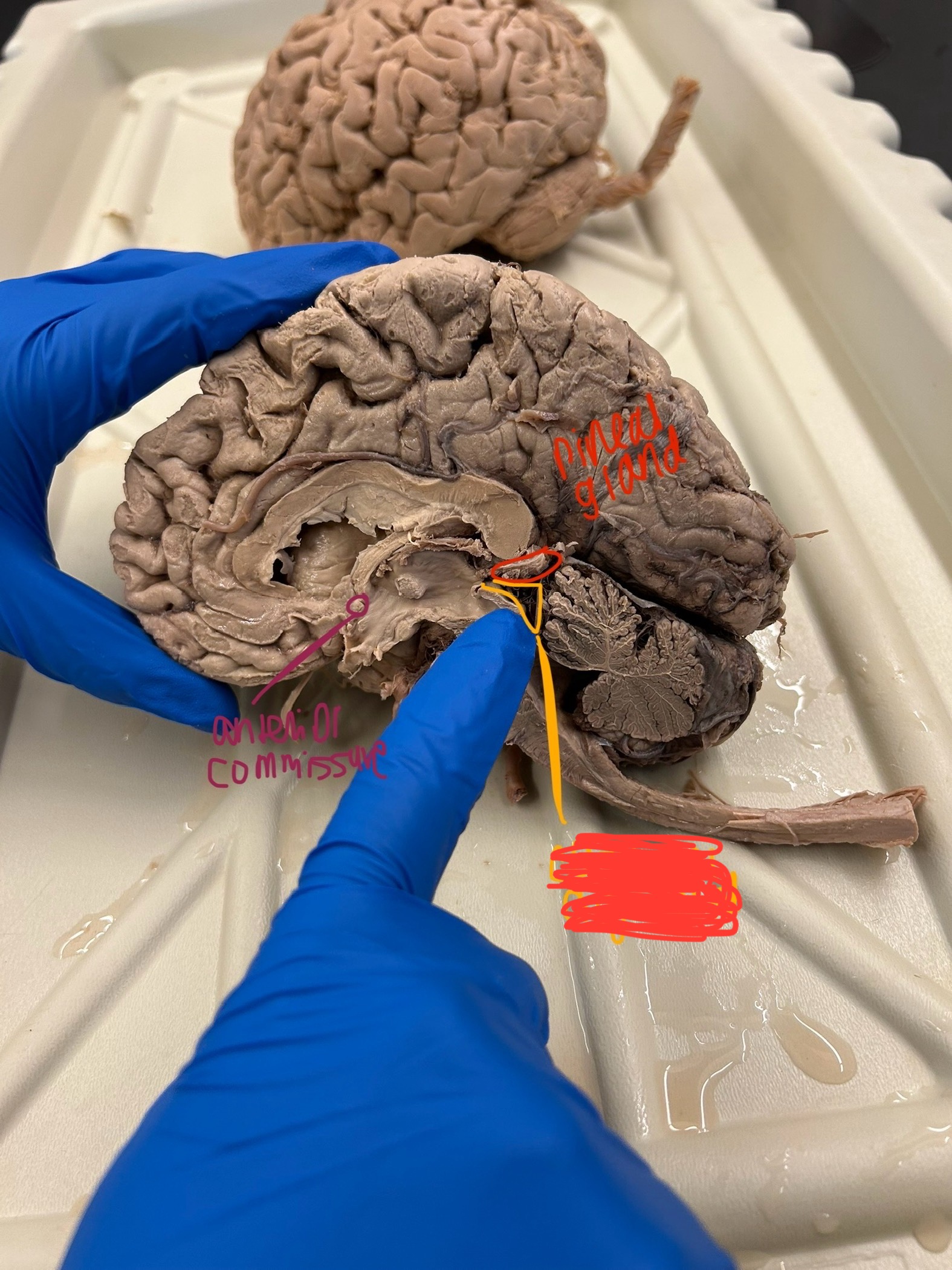 <p>What is this showing?</p>