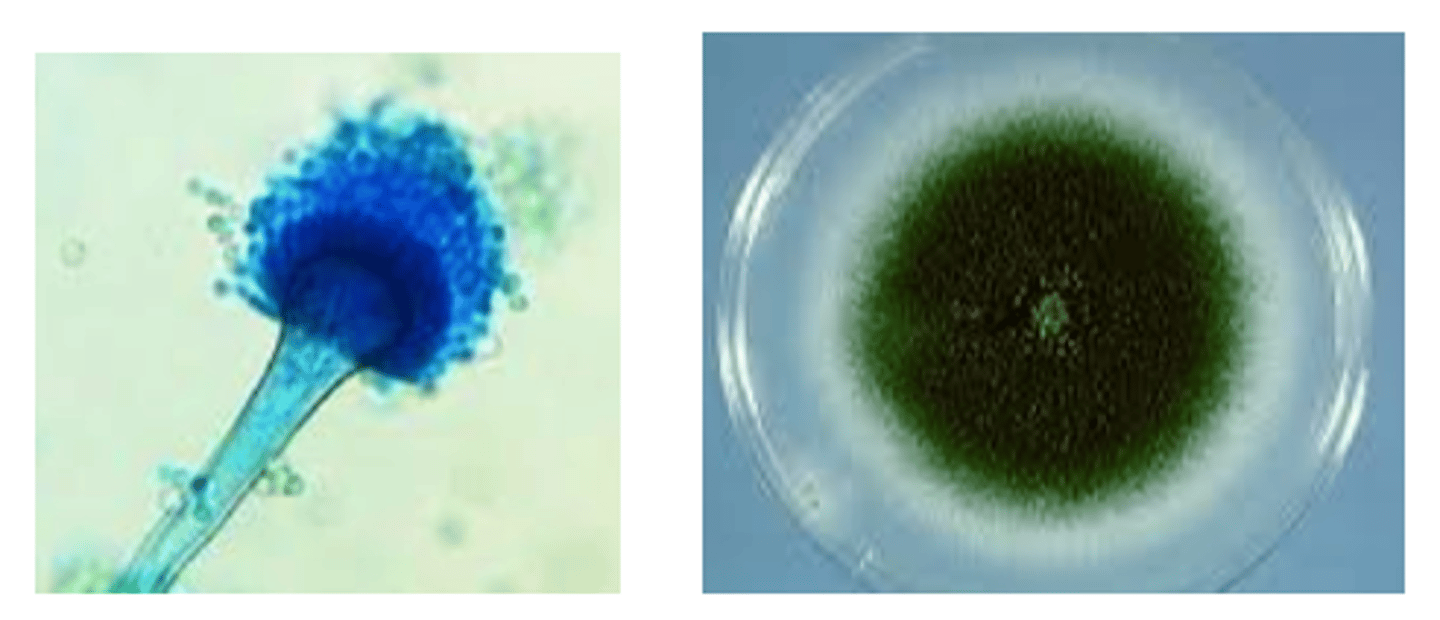 <p>· Maturity ~3 days</p><p>· Colony surface becomes dark greenish to gray; reverse white to tan; inhibited by cycloheximide</p><p>· Composed of stalk (forearm), vesicle (fist) and phialides (hair)</p><p>· Conidiophores short and smooth</p><p>· Phialides on upper 2/3 of vesicle --> mohawk haircut</p>