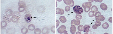 <p>What are morphology features of Plasmodium schizonts?</p>