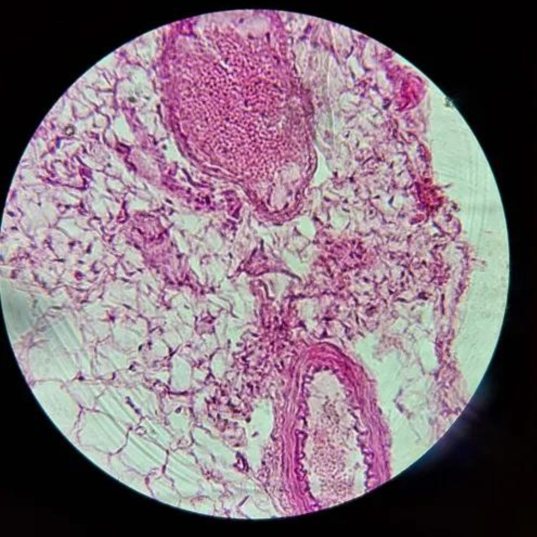 term image