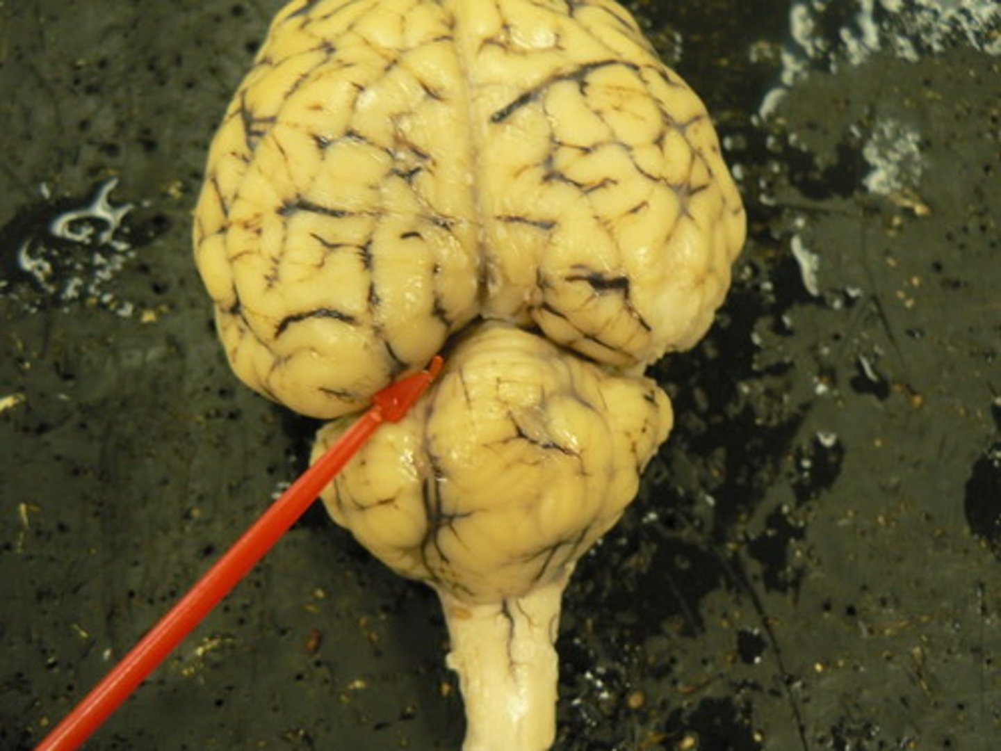 <p>separates cerebrum and cerebellum</p>