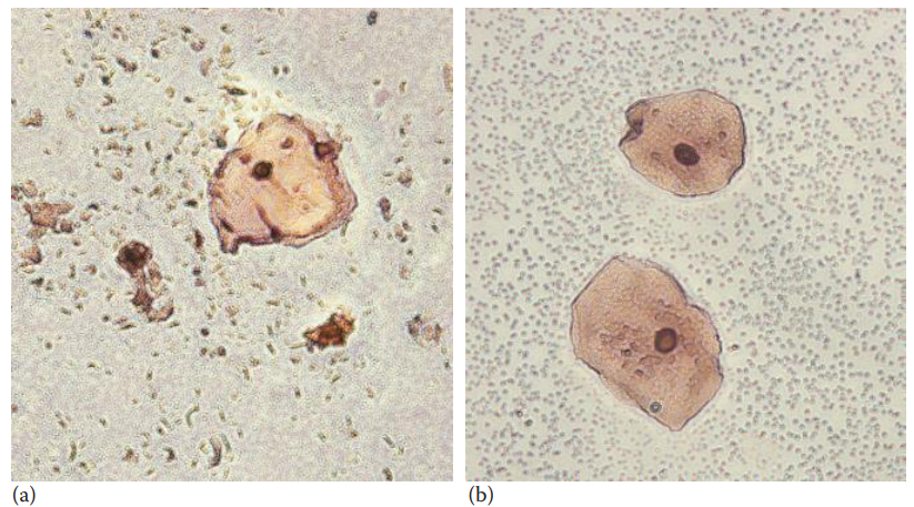 Epithelial cells stained with Lugol’s iodine solution. (a) Vaginal and (b) buccal epithelial cells. (© Richard C. Li.)