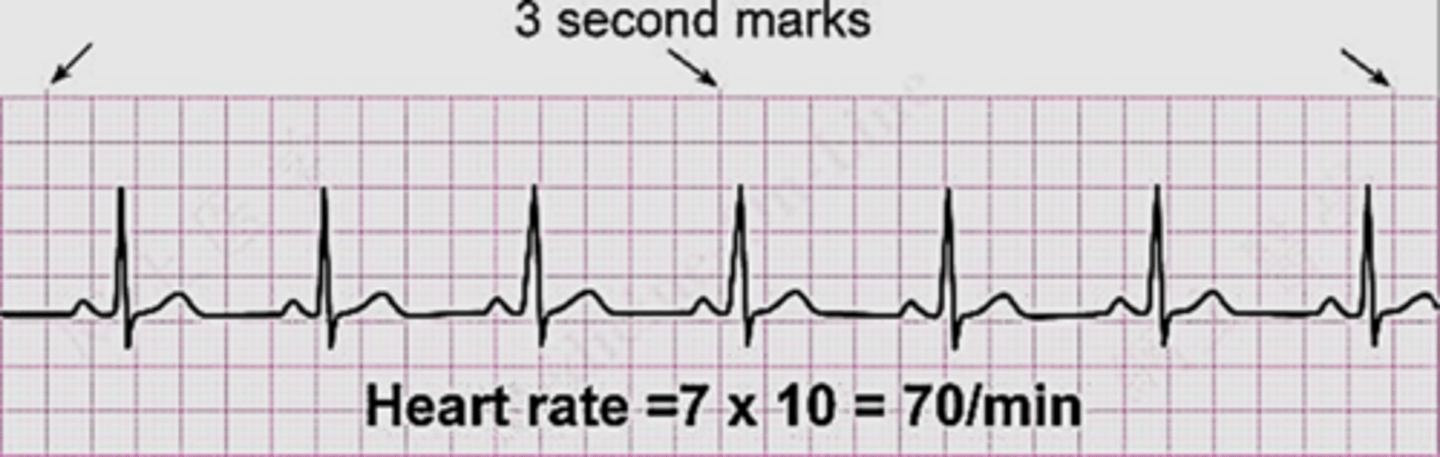 <p>count the # of complexes within 6 seconds and multiply by 10</p>