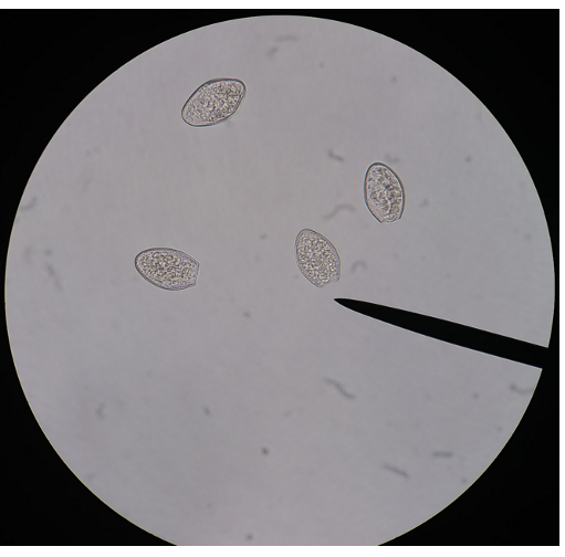<p>What type of worm is in this image?</p>