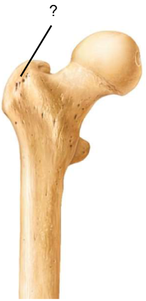 <p>Nom et caractéristiques de ce relief ?</p>