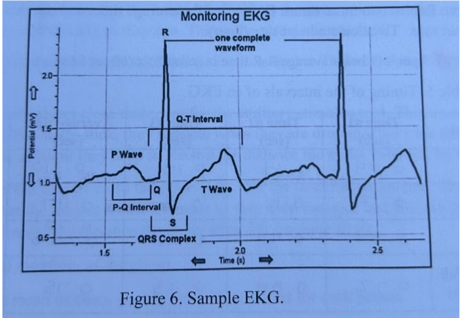 <p>Before P-wave - Electrical signal originates in the sinoatrial node<br>P wave - signal travels over atria<br>Between P and Q - signal is delayed at the atrioventricular node<br>During QRS - signal spreads across ventricles, ventricles contract<br>T wave - ventricles relax</p>