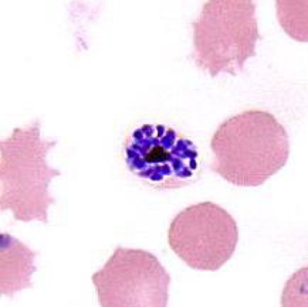 <p>Name the stage and species.</p><p>NOTE: 20-24 merozoites</p>