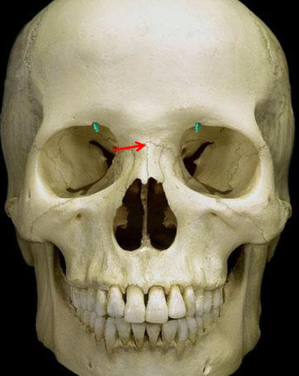 <p><em>identify the structure:</em></p>