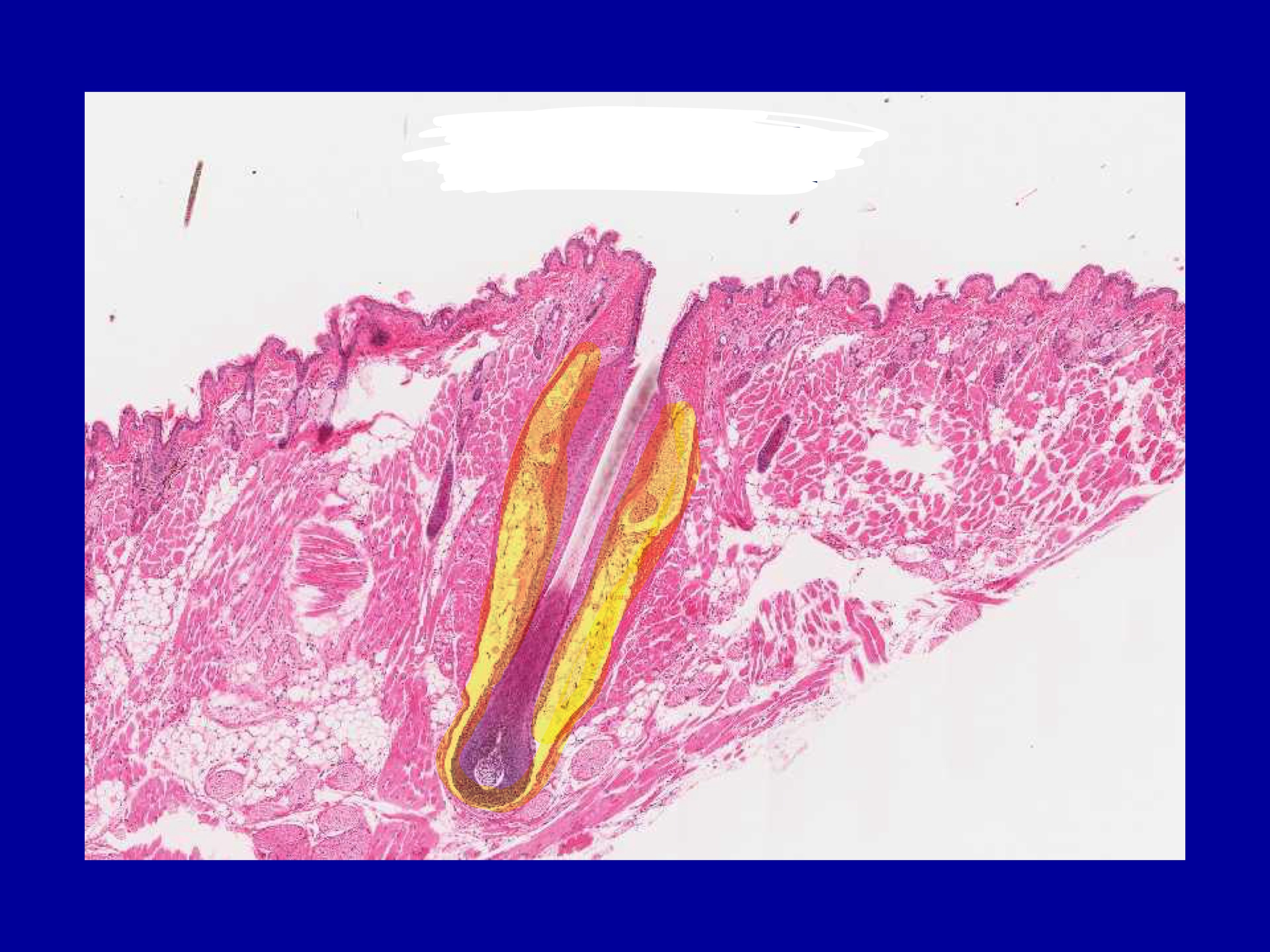 <p>what kind of hair is this?</p>