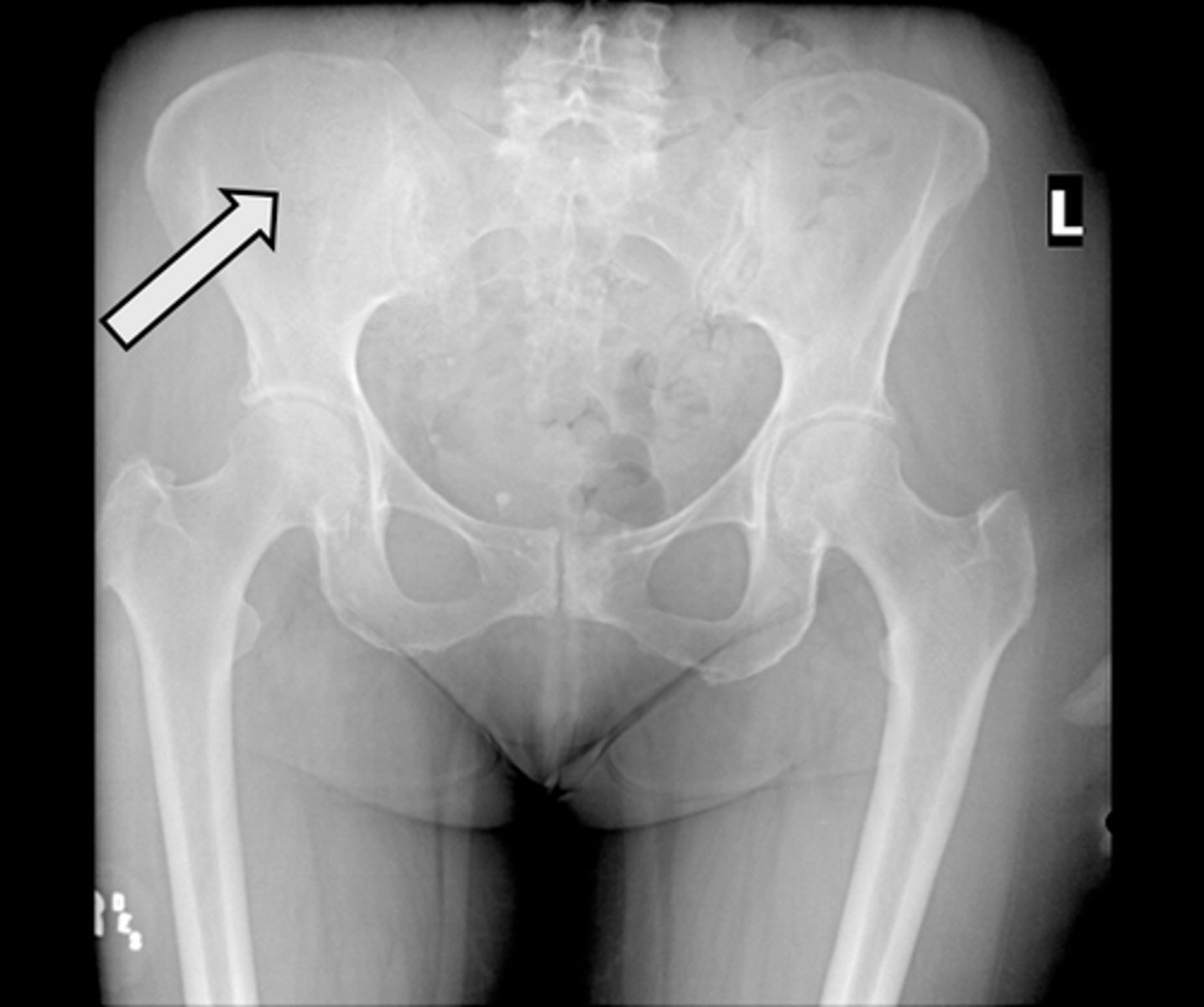 <p>What is indicated in the image?</p>