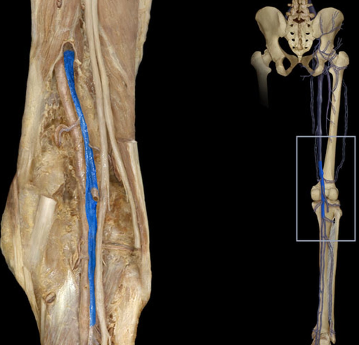 <p>A: Popliteal vein</p>