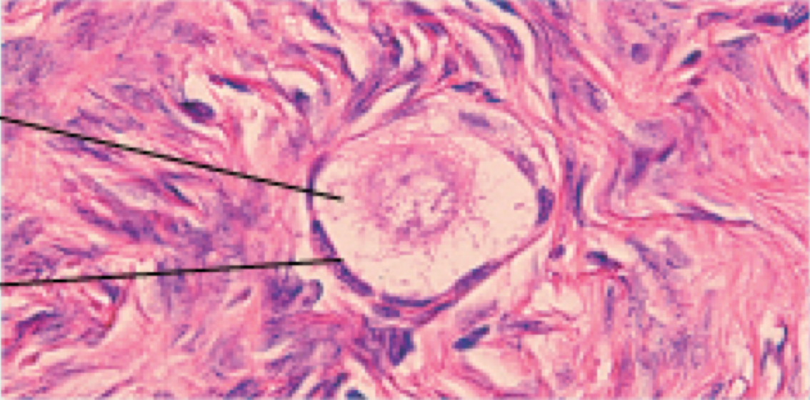 <p>Primordial follicle (ovarian cycle)</p>