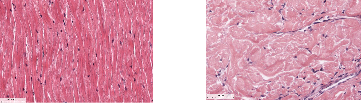 <p>Dense Regular Connective Tissue</p><p>• Fibers are arranged in parallel</p><p>• Location: Uni-directional strength, e.g. ligaments and tendons</p><p>Dense Irregular Connective Tissue</p><p>• Fibers are arranged randomly</p><p>• Location: Multi-directional strength, e.g. dermis of the skin</p>