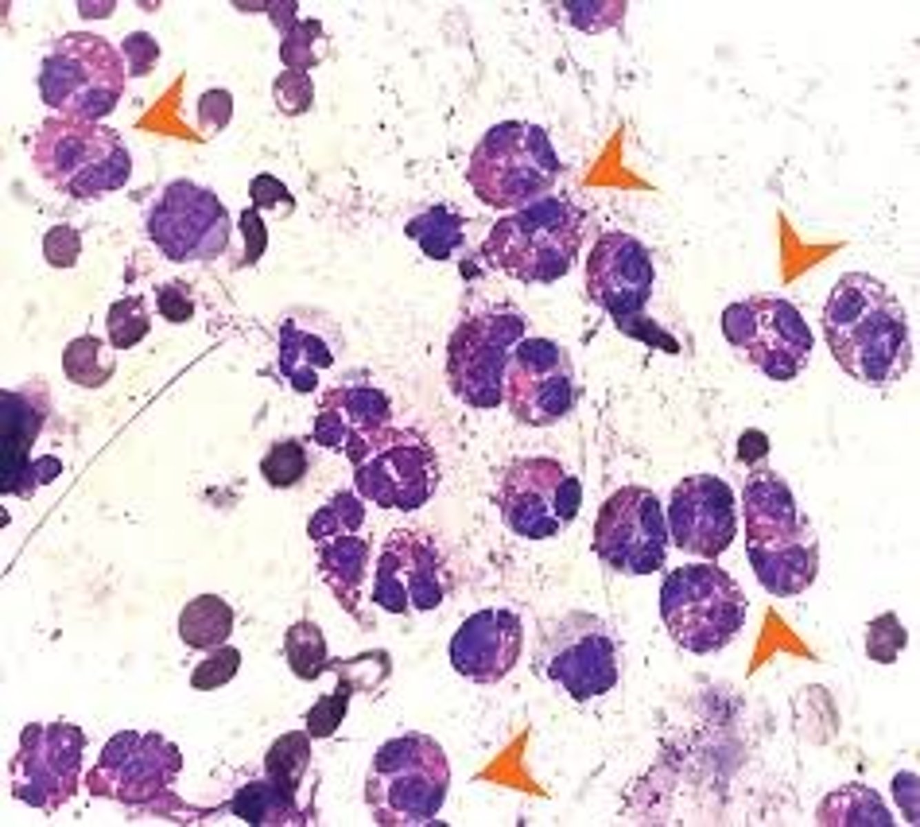 <p>Eosinophils</p>