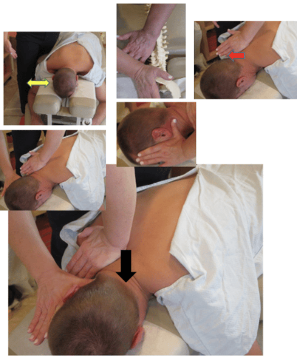 <p>• PP: Prone, headpiece below horizontal to produce slight flexion in the thoracocervical spine, permission to open gown/contact, identify segment</p><p>• DP: Standing in fencer stance on side of contact, facing cephalad, forward leg level at patient's head, body weight centered over midline of the patient</p><p>• CH: Hypothenar (pisiform) of caudal hand, contacting transverse process</p><p>• IH: #3 thumb behind the occiput with fingers alongside the face on side of contact, inducing slight lateral flexion away from contact, with distraction</p><p>• Vector: P-A</p><p>*C7-T4</p>