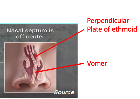<p>when the septum doesn’t run along the midline of the nasal cavity, caused by trauma to the nose or developmental abnormality. may lead to infection, inflammation, congestion, headaches, and nosebleeds and may require surgery to fix. </p>