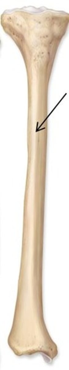 <p>Identify this bone marking.</p>