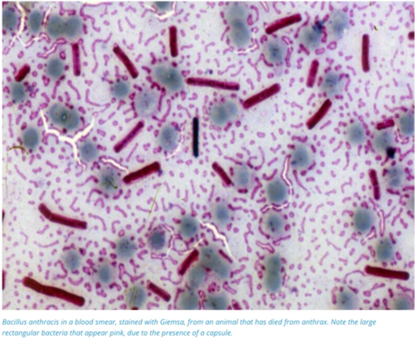 <p>Blood Smears + RAT Test (Send to Lab)</p><p>1. Obtain History of Outbreak, examine sick animals</p><p>2. Do not perform post mortem as it results in spore release</p><p>3. Take Bloods, Rapid antigen test available, send to lab to confirm</p><p>4. Make blood smears and view under microscope. Look for Brick, rod shaped pink stained bacteria (Bacteria usually altered by putrefactive processes, but capsule ruminants remain)</p>