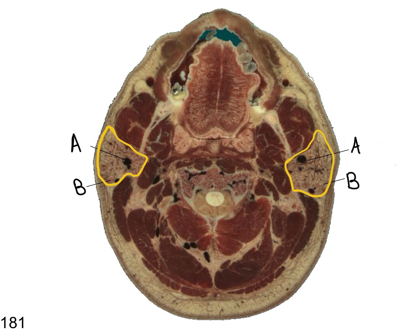<p>what structure is labeled A?</p>