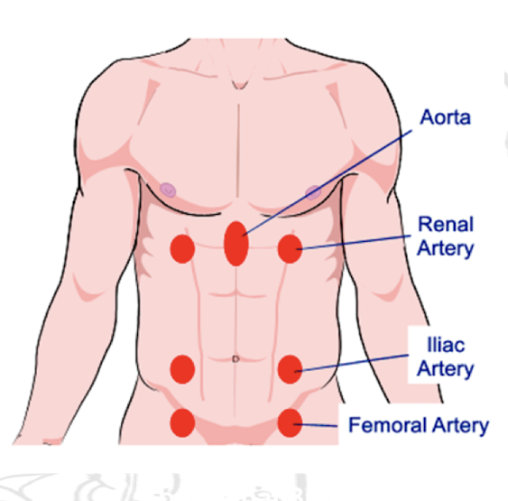 <p>Vascular abnormalities like bruits.</p>
