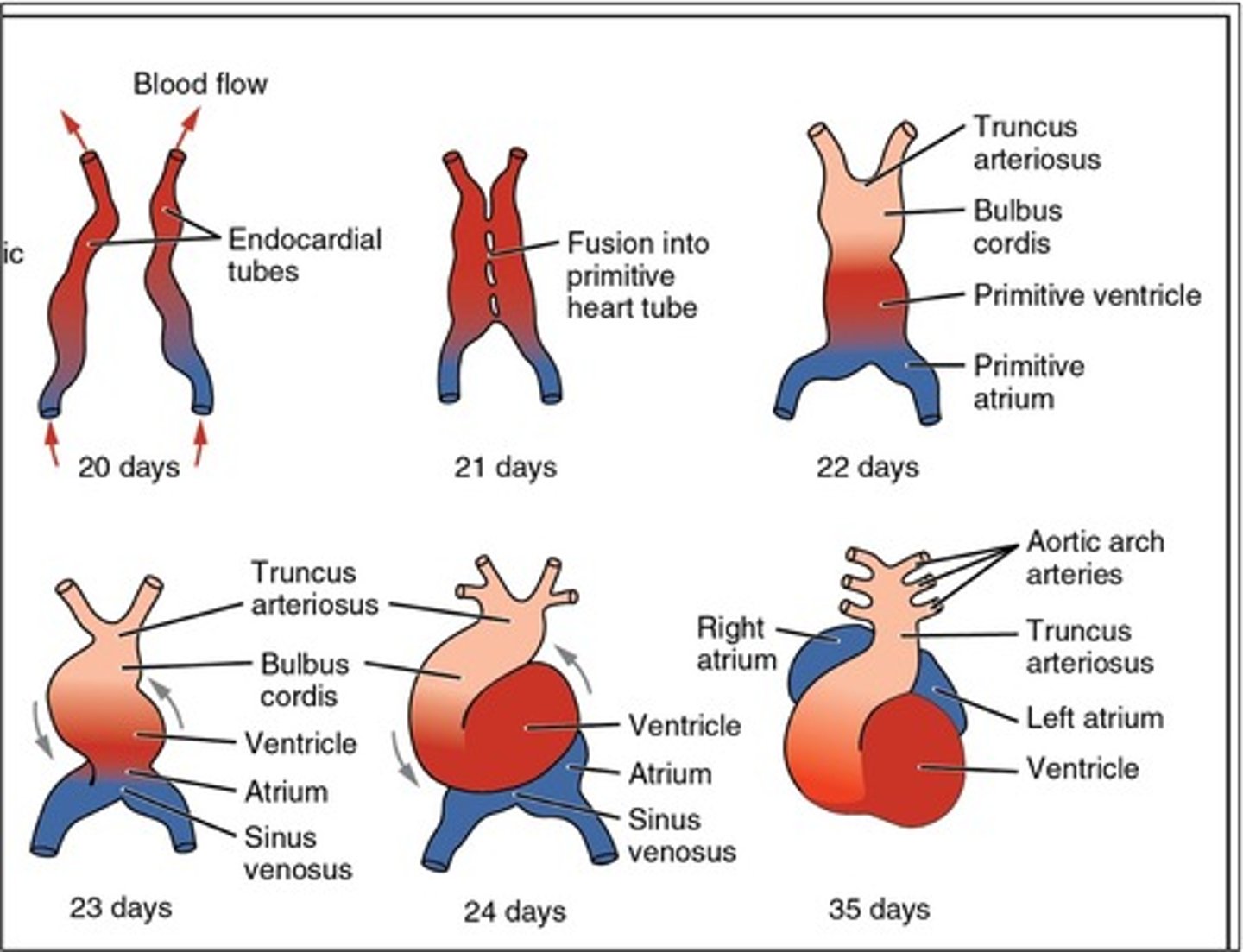 <p>right ventricle</p>