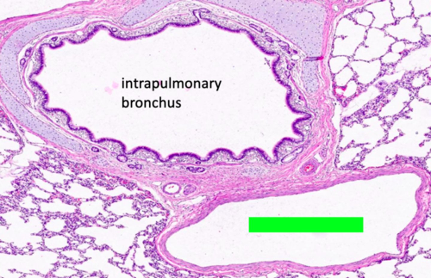 <p>ID the structure:</p>
