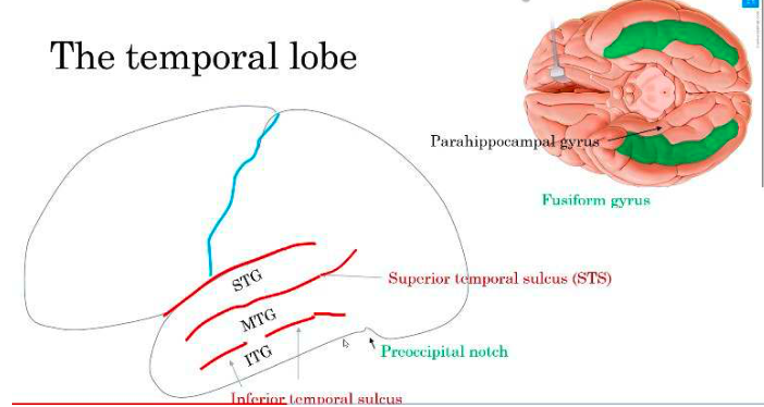 <ul><li><p>superior temporal sulcus (STS)</p></li><li><p>inferior temporal sulcus (ITS)</p></li><li><p>occipital-temporal sulcus</p></li><li><p>collateral sulcus</p></li><li><p>hippocampal sulcus </p></li></ul>