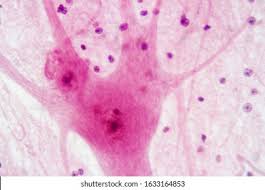 <p>jellyfish pink water color </p>