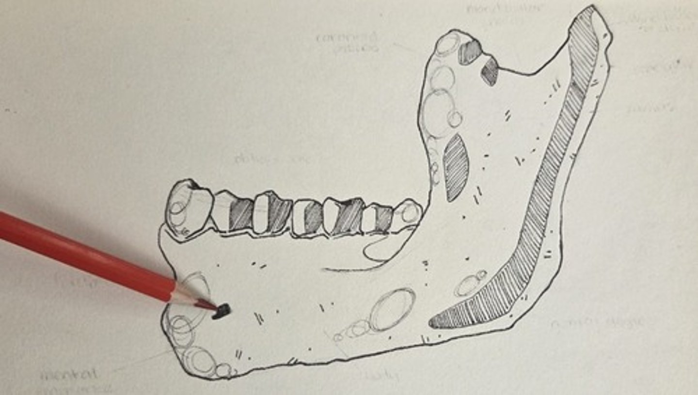 <p>the large, sometimes multiple foramen located on the lateral corpus surface, near mid-corpus, below the premolar region</p>
