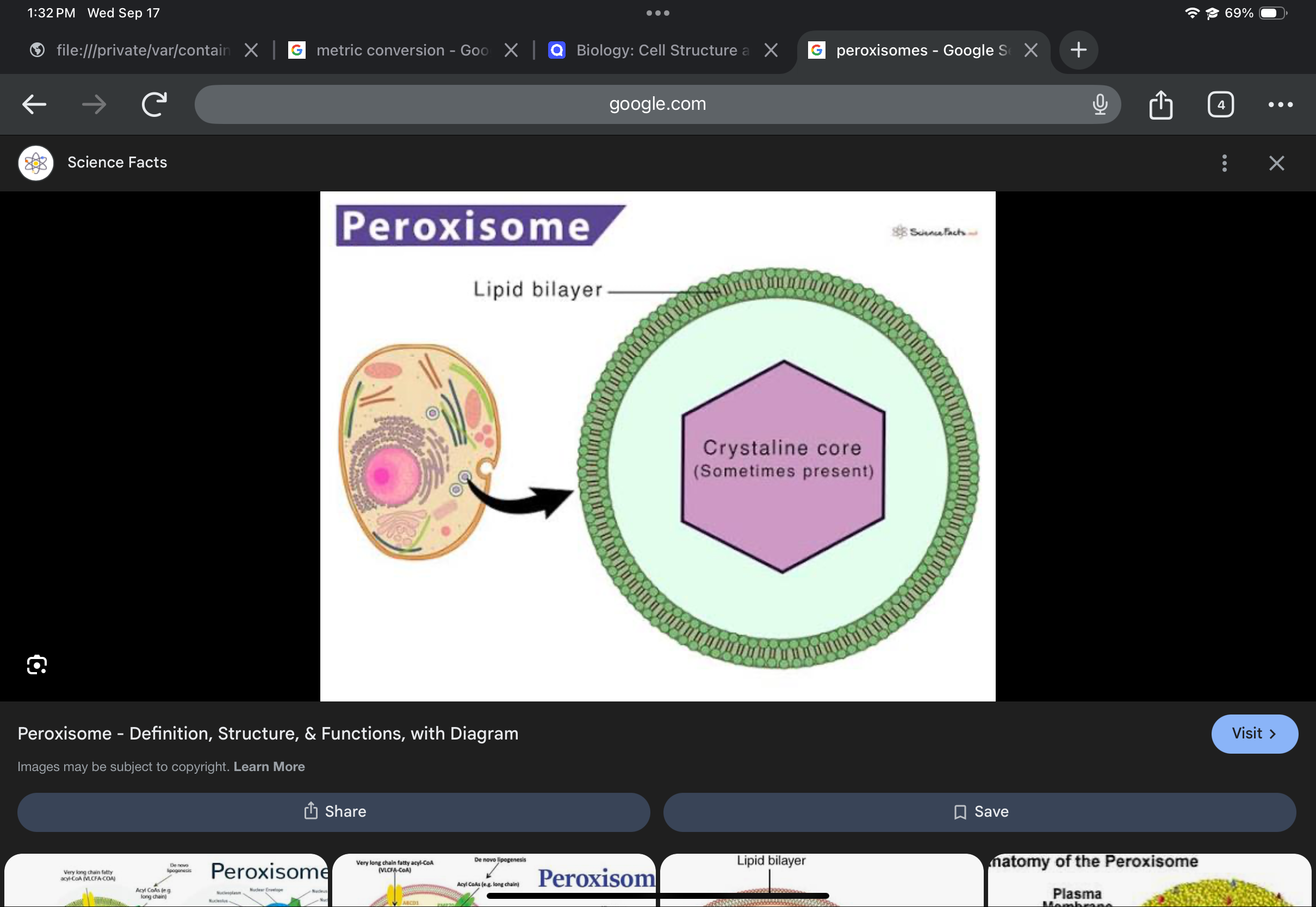 <p>Vesicle containing enzymes; breaks down fatty acids and detoxifies hydrogen peroxide.</p>