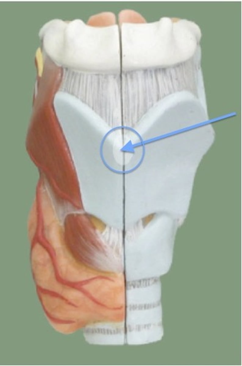 <p>the visible bump or protrusion at the front of the neck, which is a part of the thyroid cartilage. It is more prominent in males and is commonly known as the Adam's apple.</p>