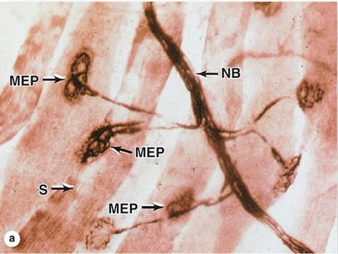 <p>Nerves branch out in the perimysium, and their terminal fibers go where?</p>