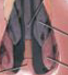 <ul><li><p>small scroll-like bones on lateral surface of nasal cavity</p></li></ul><p></p>